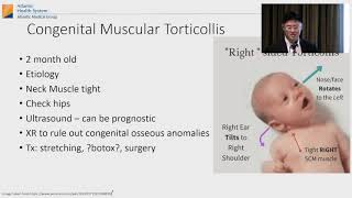 Right Torticollis Baby Stretches [upl. by Nrublim]