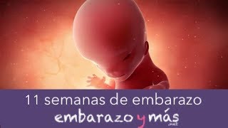 11 semanas de embarazo  Tercer mes  EMBARAZOYMAS [upl. by Amsed]