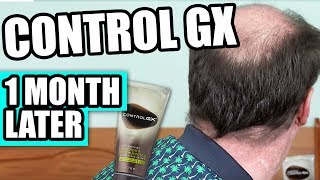 Control GX One Month Follow Up [upl. by Salis560]