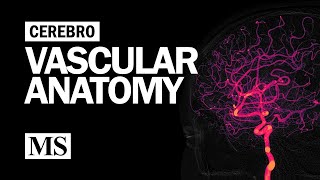 Cerebral Venous Sinus Thrombosis CVST Animation [upl. by Critchfield306]