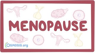 Metaplasia  Cell Adaptations 33  General Pathology  EOMS [upl. by Dnanidref]