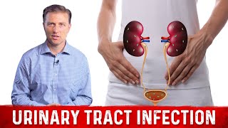 Best Home Remedy for Urinary Tract Infection UTI – Dr Berg [upl. by Prudhoe]