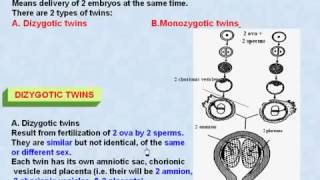 44 General Embryology Twins amp Dizygotic Twins [upl. by Htenay]