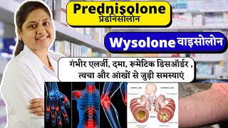 Prednisolone  Prednisone  गंभीर एलर्जी दमा रूमेटिक डिसऑर्डर  Wysolone  Wysolone 10 mg [upl. by Arted]