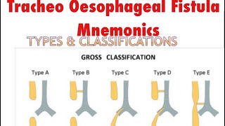 APGO Basic Sciences  Topic 20 Mullerian Anomalies [upl. by Aranaj]