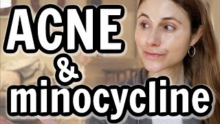 Minocycline versus doxycycline for acne Dr Dray [upl. by Nedra]