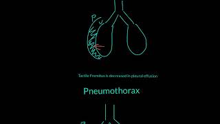 Tactile Fremitus Explained [upl. by Hcra]