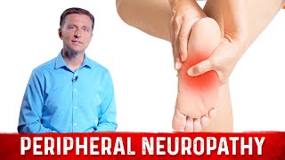 How to Relieve Peripheral Neuropathy Pain – Dr Berg [upl. by Grindle]