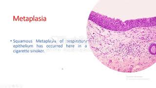 Cellular adaptation Metaplasia [upl. by Ume468]