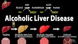 Alcoholic Liver Disease Animation [upl. by Ellemrac580]