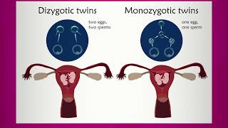 Learning about Multiple Pregnancy [upl. by Tellford]