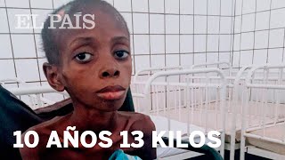 Marcos un niño desnutrido en Angola  Planeta Futuro [upl. by Wales230]