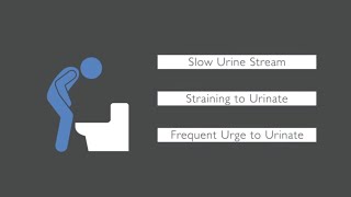 Trouble Urinating What Causes Urinary Issues in Men [upl. by Urbanna859]