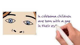 Microphthalmia Anophthalmia and Coloboma [upl. by Thedrick]