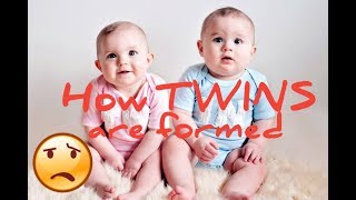 HOW TWINS ARE FORMED  IDENTICAL amp NONIDENTICAL TWINS [upl. by Ulric904]