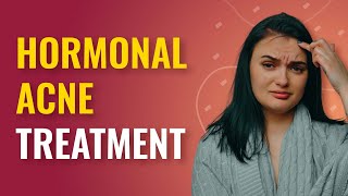 Hormonal Acne Treatment How to Get Rid of Hormonal Acne  MFine [upl. by Fabrienne]