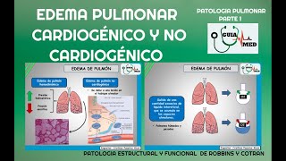 EDEMA PULMONAR CARDIOGÉNICO Y NO CARDIOGÉNICO  GuiaMed [upl. by Henghold430]