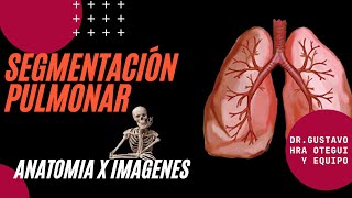 Segmentación pulmonar en Tomografia [upl. by Arikehs531]